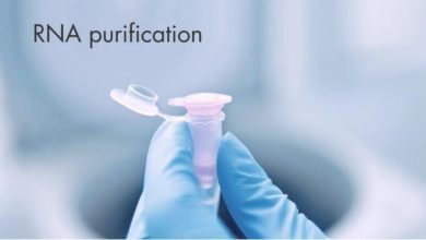 روش های از بین بردن DNA ژنومی در RNA استخراج شده