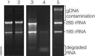 آلودگی DNA ژنومی در RNA استخراج شده