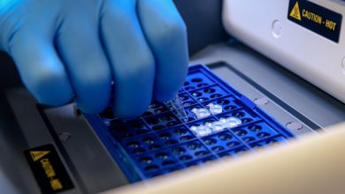 سنتز cDNA از RNA استخراج شده از سلول و بافت