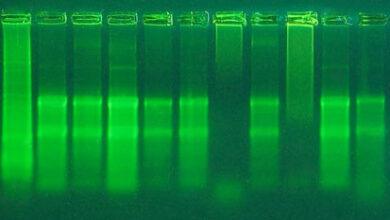 عیب یابی استخراج RNA