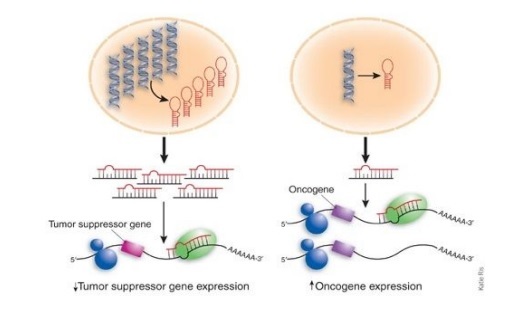 میکرو RNA ها و سرطان