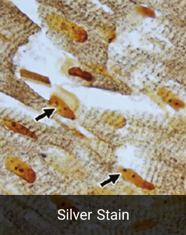 روش رنگ آمیزی سلول عصبی