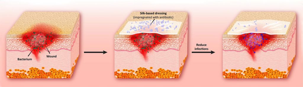 پانسمان حیوانات آزمایشگاهی پانسمان ضدباکتریای Antimicrobial dressings