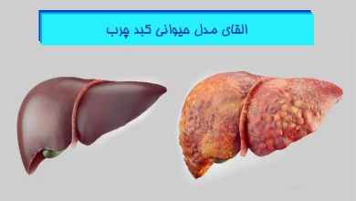 آموزش جامع نحوه ایجاد کبد چرب در موش آزمایشگاهی