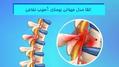 القای آسیب نخاعی در حیوانات آزمایشگاهی - هیستوژنوتک