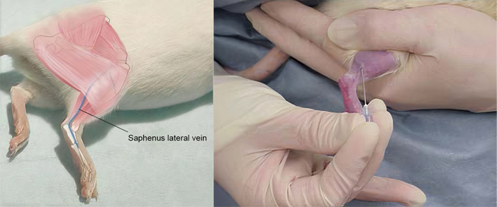  خونگیری از ورید جانبی صافن ( Saphenus lateral vein )