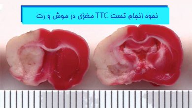 تست TTC مغزی موش و رت
