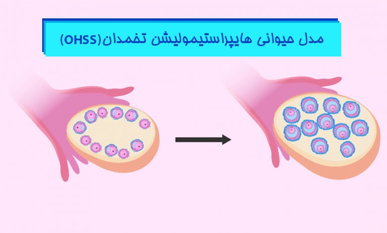 القای مدل حیوانی هایپراستیمولیشن تخمدان Ohss