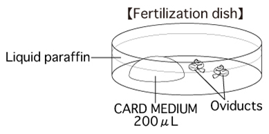 لقاح آزمایشگاهی IVF
