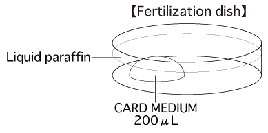 لقاح آزمایشگاهی IVF
