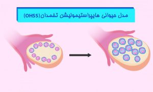 القای مدل حیوانی هایپراستیمولیشن تخمدان Ohss