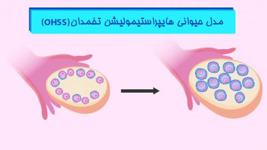 القای مدل حیوانی هایپراستیمولیشن تخمدان Ohss