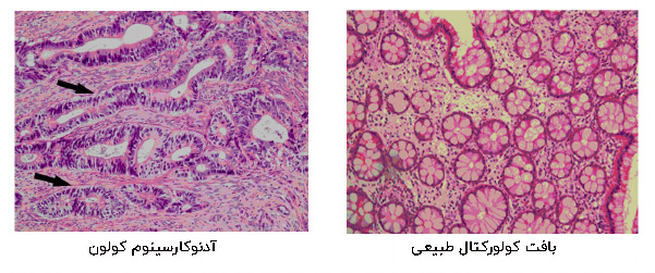 رنگ آمیزی هماتوکسیلین و ائوزین H&E