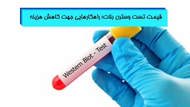 انجام تست وسترن بلات با قیمت مناسب