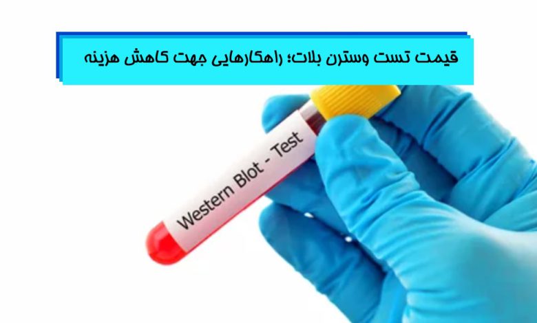انجام تست وسترن بلات با قیمت مناسب