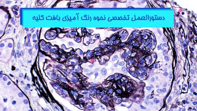 رنگ آمیزی بافت کلیه - راهکارها و دستورالعمل ها
