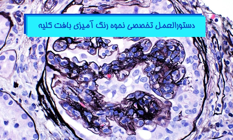 رنگ آمیزی بافت کلیه - راهکارها و دستورالعمل ها