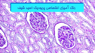 دستورالعمل قدم به قدم رنگ آمیزی پاس (PAS)
