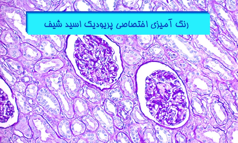 دستورالعمل قدم به قدم رنگ آمیزی پاس (PAS)
