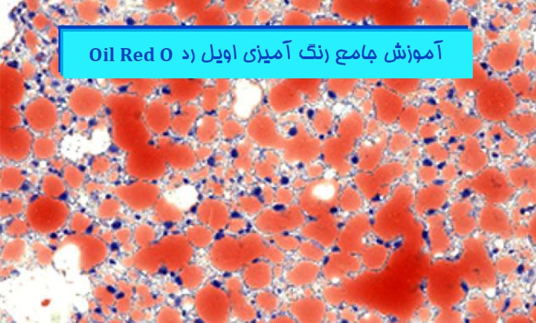 آموزش جامع رنگ آمیزی اویل رد در پاتولوژی - هیستوژنوتک