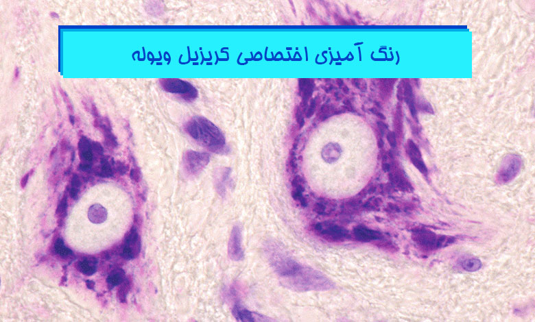 آموزش جامع کریزیل ویوله - نیسل