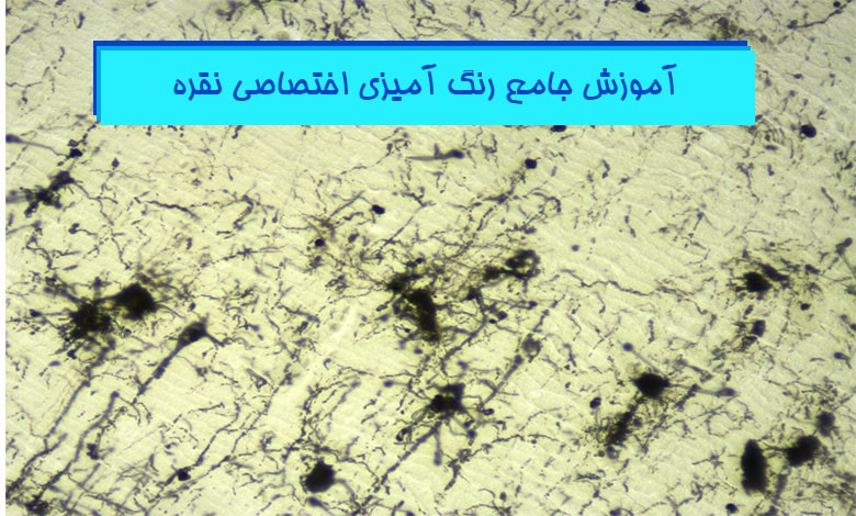 آموزش روش رنگ آمیزی نقره و رنگ آمیزی گلژی در بافت شناسی