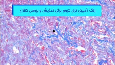 رنگ-آمیزی-تری-کروم-برای-نمایش-و-بررسی-کلاژن