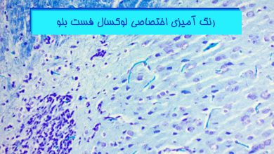 رنگ-آمیزی-لوکسال-فست-بلو-(luxol-fast-blue)