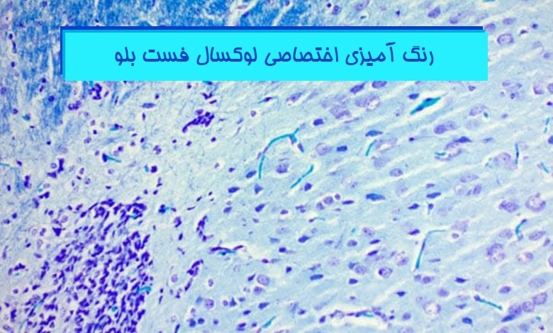 رنگ-آمیزی-لوکسال-فست-بلو-(luxol-fast-blue)