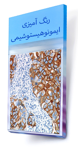 رنگ-آمیزی-اختصاصی-ایمونوهیستوشیمی