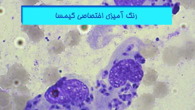 آموزش رنگ آمیزی اختصاصی گیما Giemsa در پاتولوژی - هیستوژنوتک