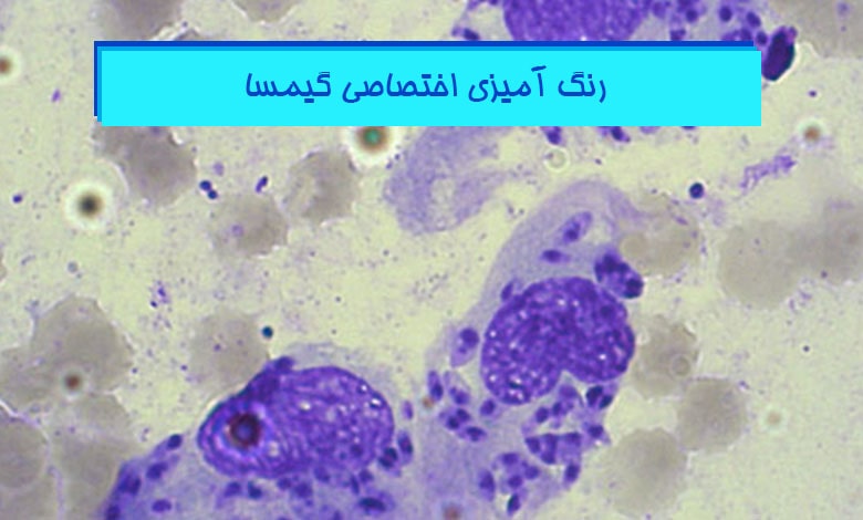 آموزش رنگ آمیزی اختصاصی گیما Giemsa در پاتولوژی - هیستوژنوتک