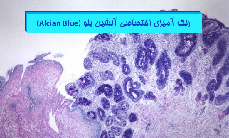 آموزش مراحل رنگ آمیزی آلشین بلو در پاتولوژی