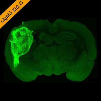 تخفیف پاییزه هیستوژنوتک - Neuroscience disease model