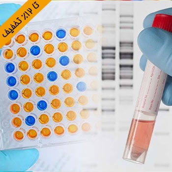 تخفیف پاییزه هیستوژنوتک - Western Blot & Elisa