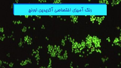 رنگ آمیزی آکریدین اورنج در بافت شناسی - هیستوژنوتک