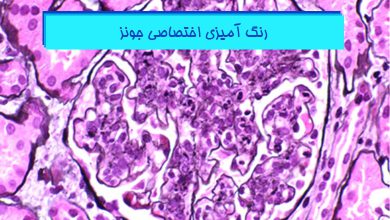 نکات رنگ آمیزی جونز (Jones)