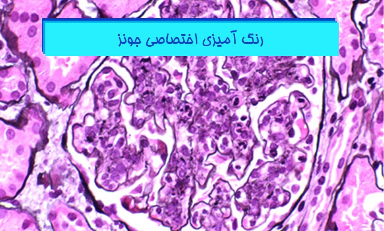 نکات رنگ آمیزی جونز (Jones)