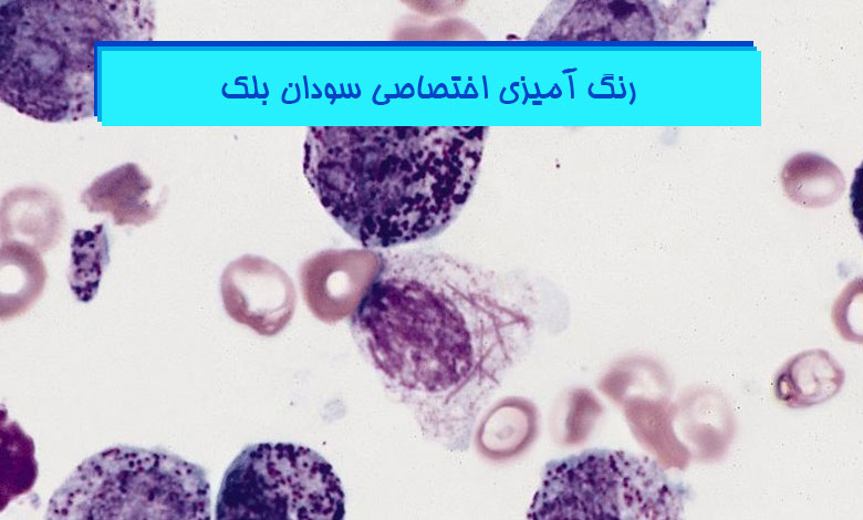رنگ آمیزی اختصاصی سودان بلک - هیستوژنوتک