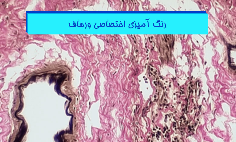 رنگ آمیزی اختصاصی ورهاف در بافت شناسی - هیستوژنوتک