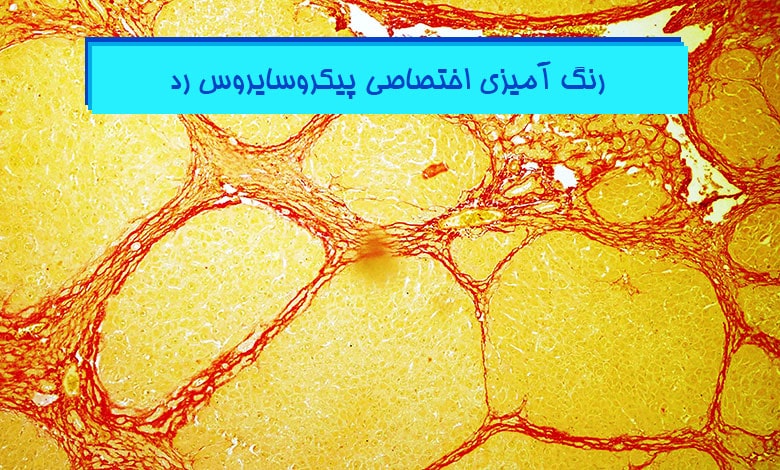 رنگ-آمیزی-اختصاصی-پیکرو-سایروس-رد-هیستوژنوتک