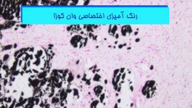 آموزش رنگ آمیزی وان کوزا در پاتولوژی