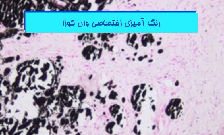 آموزش رنگ آمیزی وان کوزا در پاتولوژی