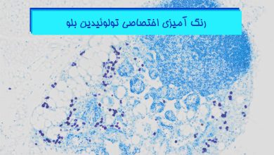 رنگ آمیزی اختصاصی تولوئیدین بلو