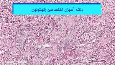 رنگ-آمیزی-اختصاصی-رتیکولین-در-بافت-شناسی-هیستوژنوتک