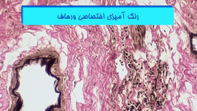 رنگ آمیزی اختصاصی ورهاف در بافت شناسی - هیستوژنوتک