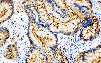IHC 1